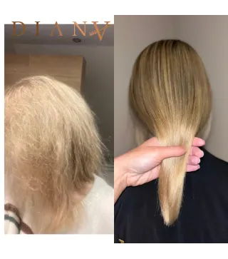 Pre-Nano Botox Włosów 1000ml – Brazylijska, certyfikowana terapia naprawcza dla zniszczonych włosów