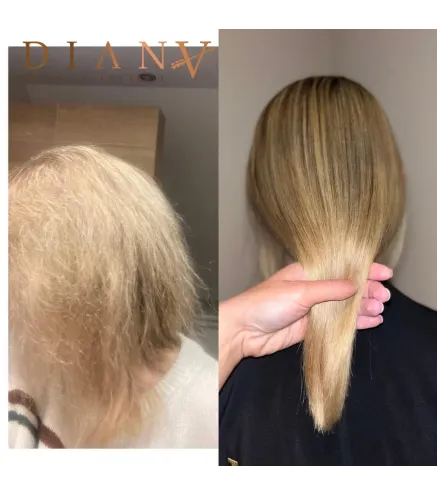 Pre-Nano Botox Włosów 1000ml – Brazylijska, certyfikowana terapia naprawcza dla zniszczonych włosów